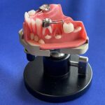 model holder, lab model tool, rosco ortho model holder